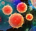 researchers-at-the-nih-identify-an-autoinflammatory-condition-brought-on-by-lyn-gene-mutations