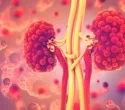 dna-pkcs-is-a-newly-discovered-target-for-the-therapy-of-chronic-renal-disease