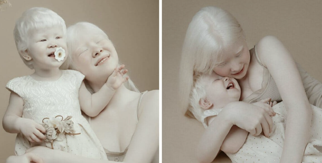 albino-sisters-born-12-years-apart-become-modeling-sensations