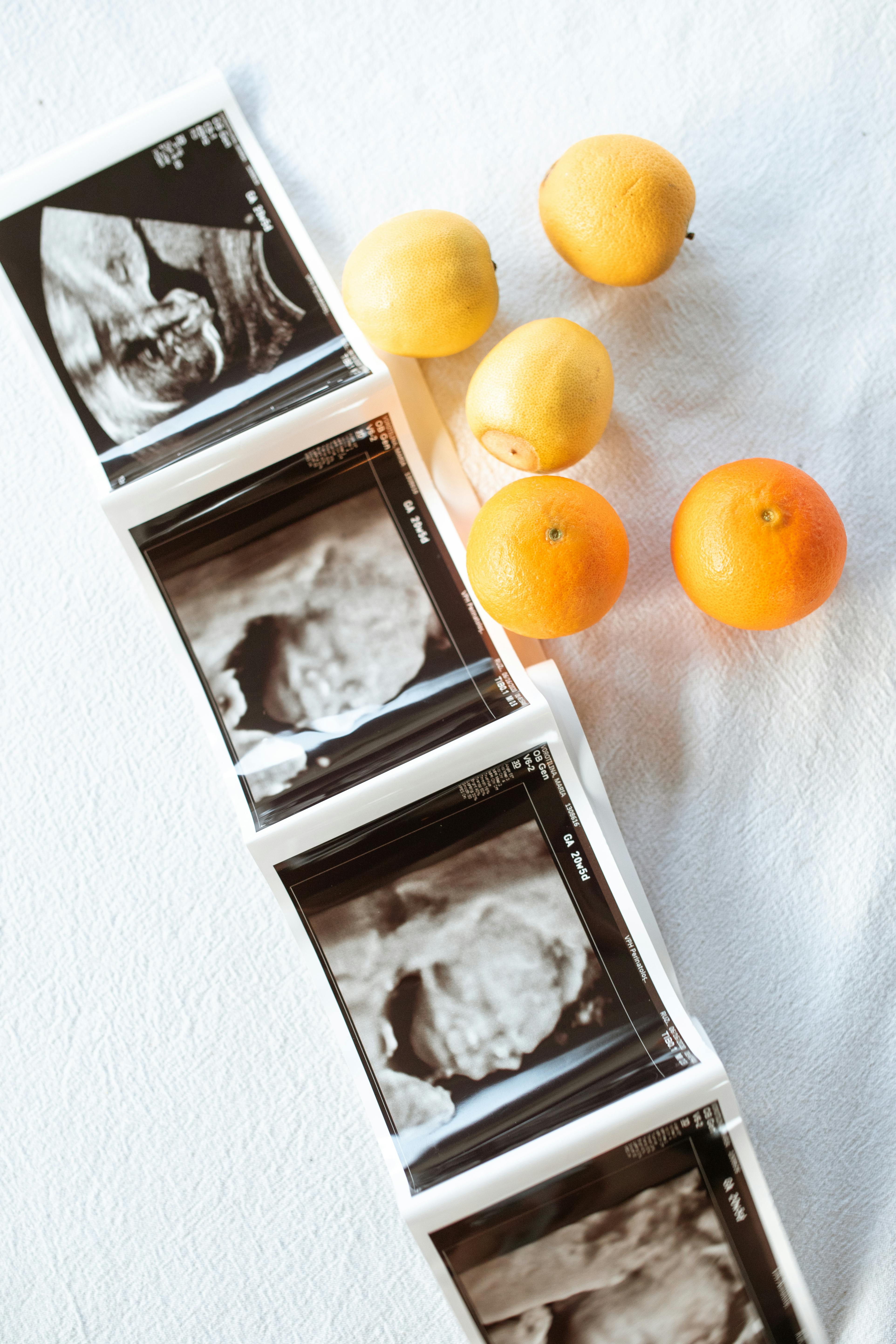 A fetal ultrasound | Source: Pexels