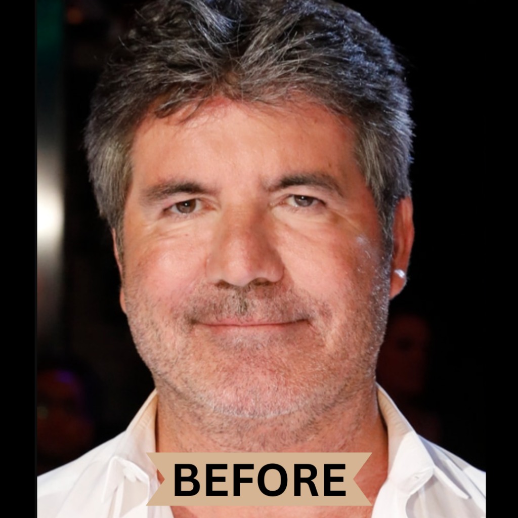 ‘agt’-star-simon-cowell-removed-his-facial-fillers-after-not-recognizing-himself-–-before-&-after-photos