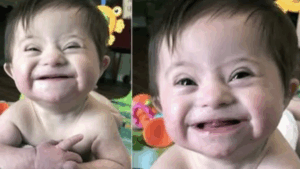 adopted-baby-with-down-syndrome-goes-viral-after-smiling-for-mom