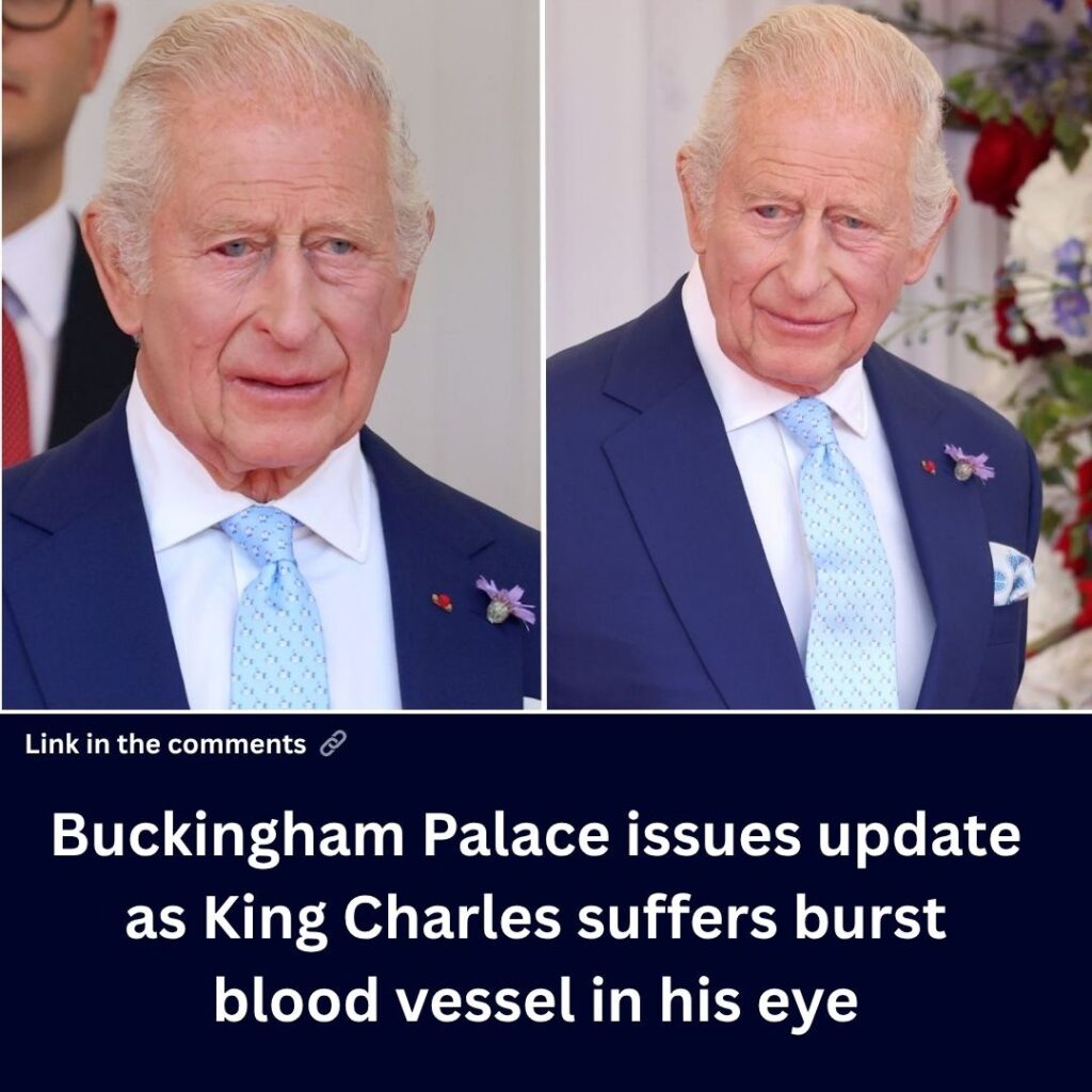 buckingham-palace-issues-update-as-king-charles-suffers-burst-blood-vessel-in-his-eye
