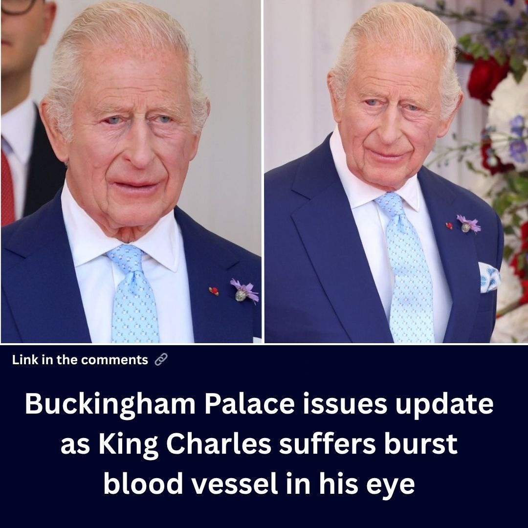 Buckingham Palace issues update as King Charles suffers burst blood vessel in his eye